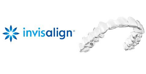 豊富なインビザラインの実績