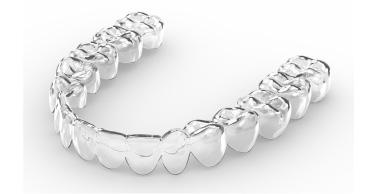 金属を使わないマウスピース矯正で金属アレルギーも心配なし